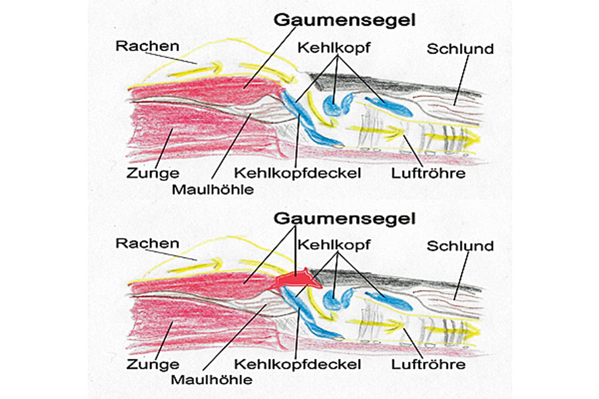 Brachycephalensyndrom Vergleich von normalen anatomischen und den pathologischen Verhältnis im Querschnitt