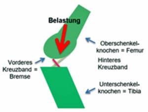 Kreuzbandriss Abbildung des Kniegelenkes eines Hund. Schematische Darstellung