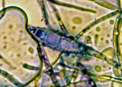 Mit den Makrokonidien kann man den Nachweis von Pilzen führen. Dermatophyton canis mit den septierten Hyphen.